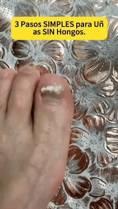 PARCHE UÑAS ANTIHONGOS